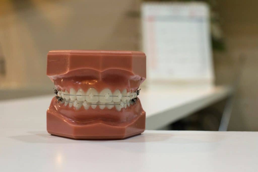 se-puede-llevar-ortodoncia-con-implantes