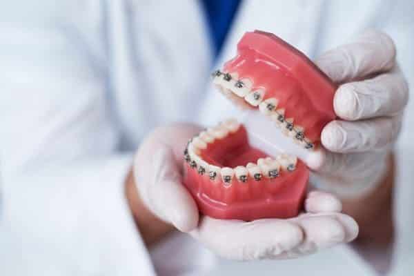Tienes-mala-mordida-maloclusion-clinica-dental-Riojadental-logrono
