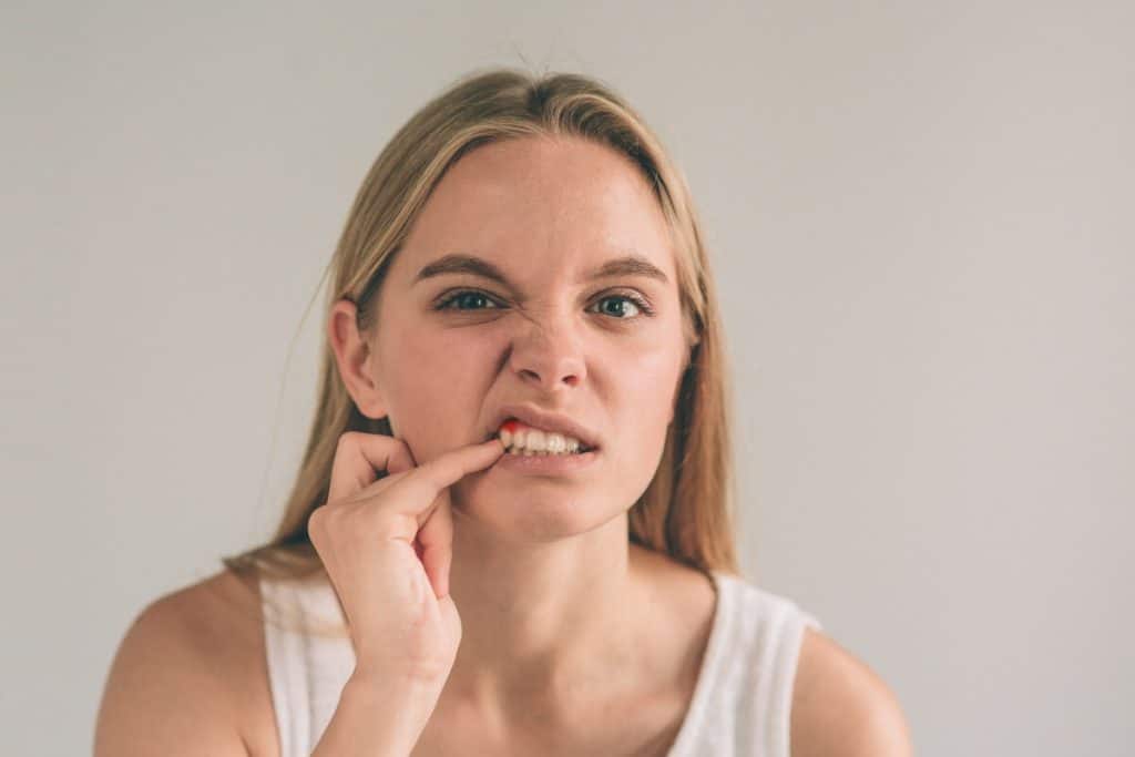 periodontitis-por-cambios-hormonales