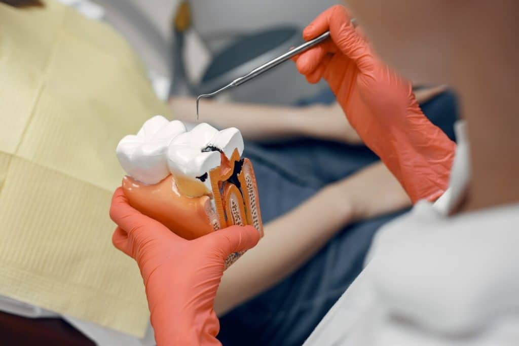 causas-necesitas-hacerte-endodoncia