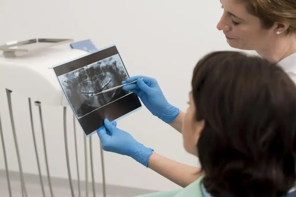 Cuándo es necesario extraer las muelas del juicio - dentista en logroño clinica dental riojadental