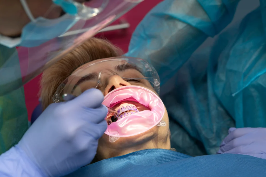 Limpieza dental con sistema GBT: la nueva forma de cuidar tu sonrisa sin molestias 2 45A9336