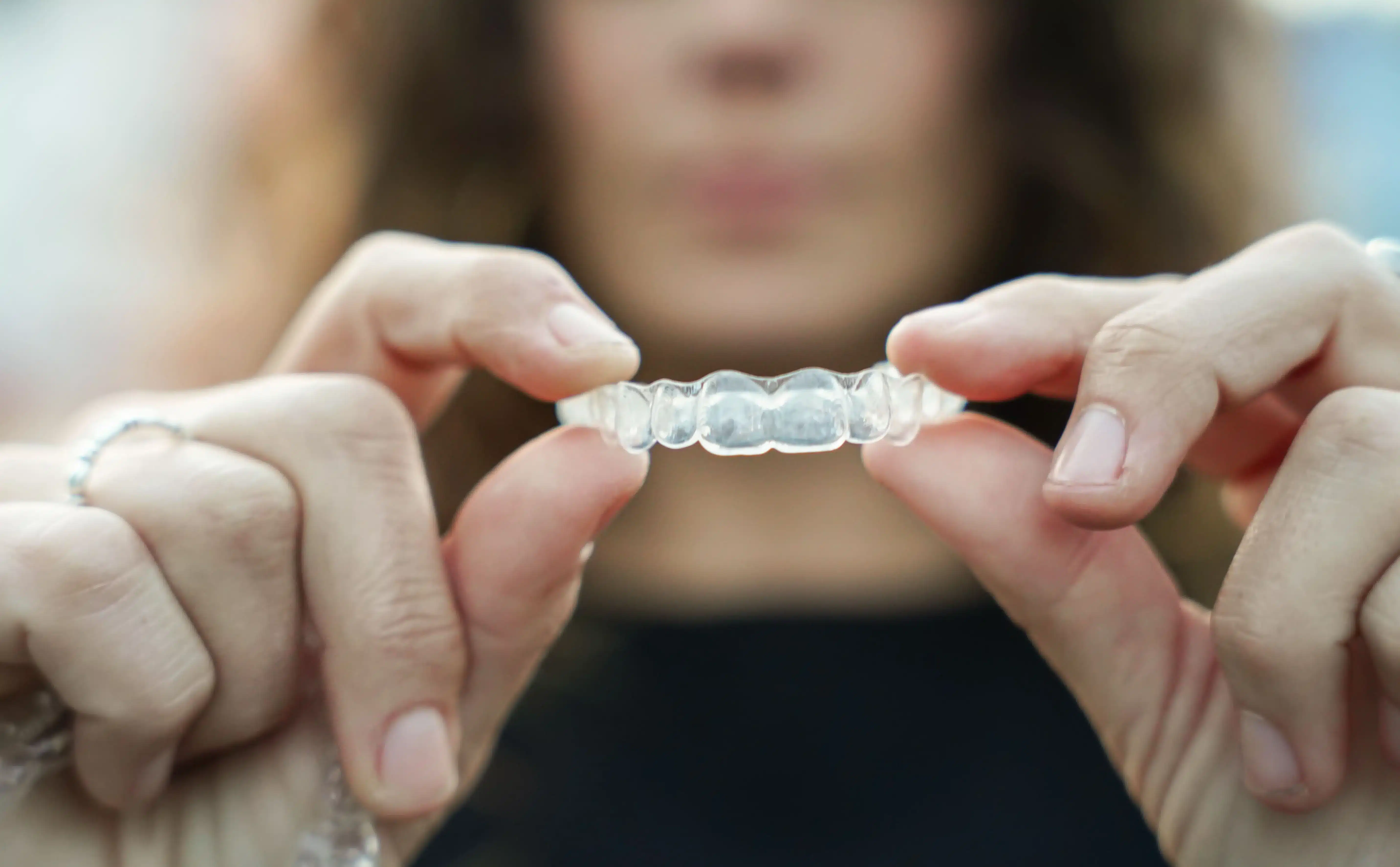 Blog 6 Retenedores tras ortodoncia en logroño por qué se mueven los dientes si dejo de usarlos riojadental