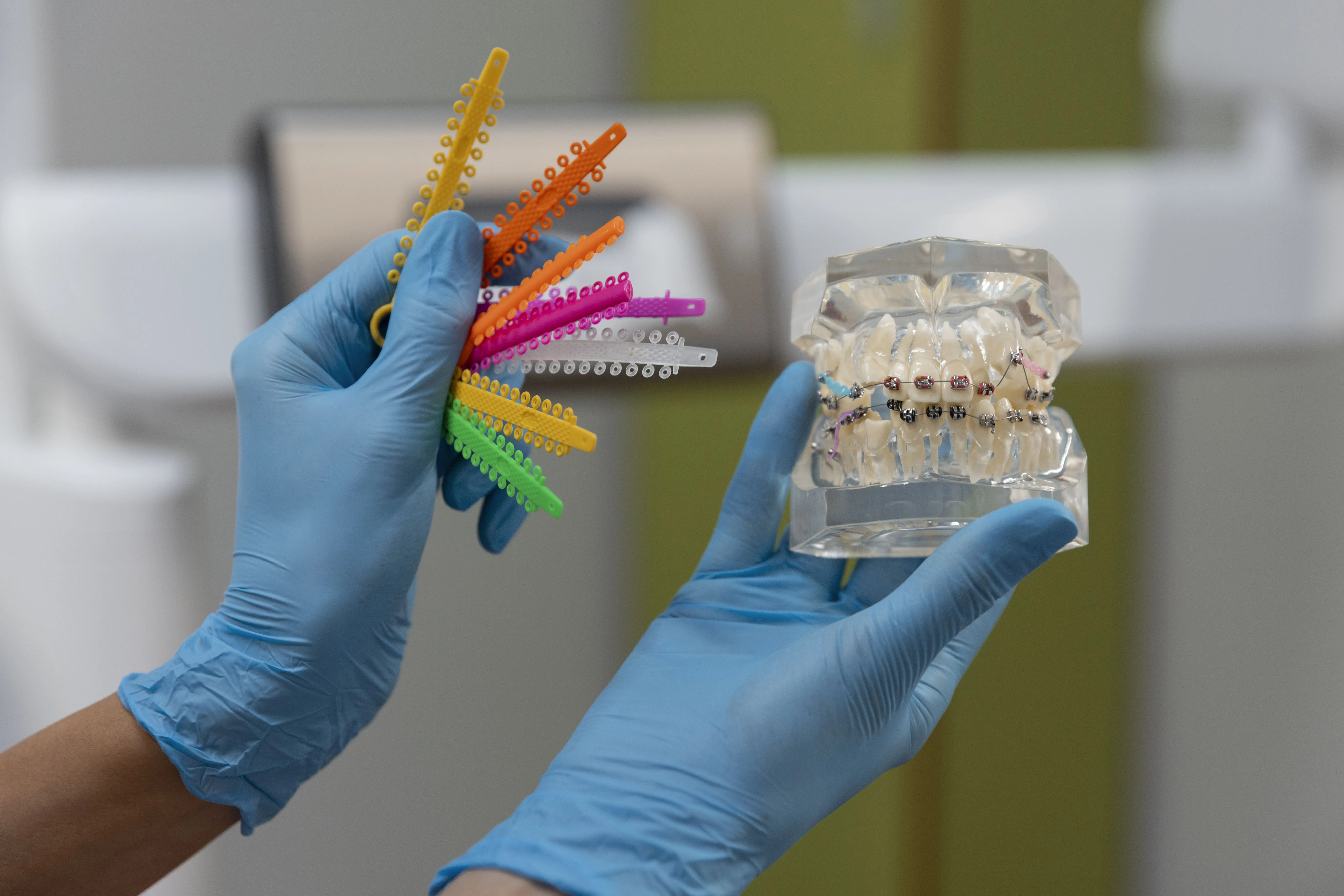Blog 3 Brackets metálicos o estéticos diferencias y cómo elegir ortodoncia en logroño riojadental