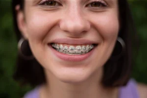Cuánto dura un tratamiento de ortodoncia con brackets en logroño riojadental