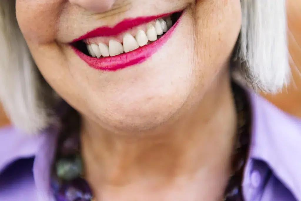 Implante o puente dental en logroño clinica dental riojadental cómo se elige la mejor opción