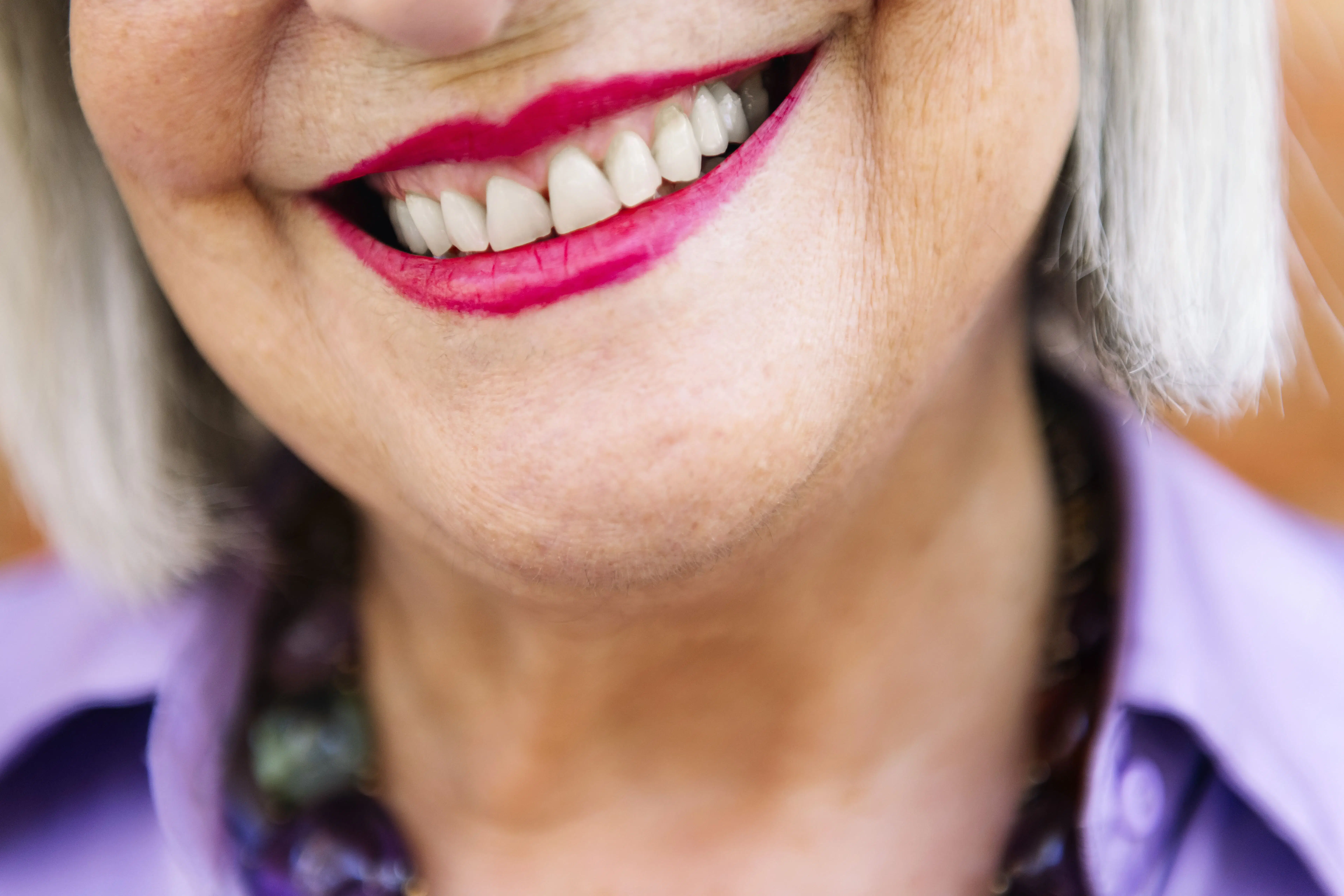 Blog 6 Implante o puente dental en logroño clinica dental riojadental cómo se elige la mejor opción